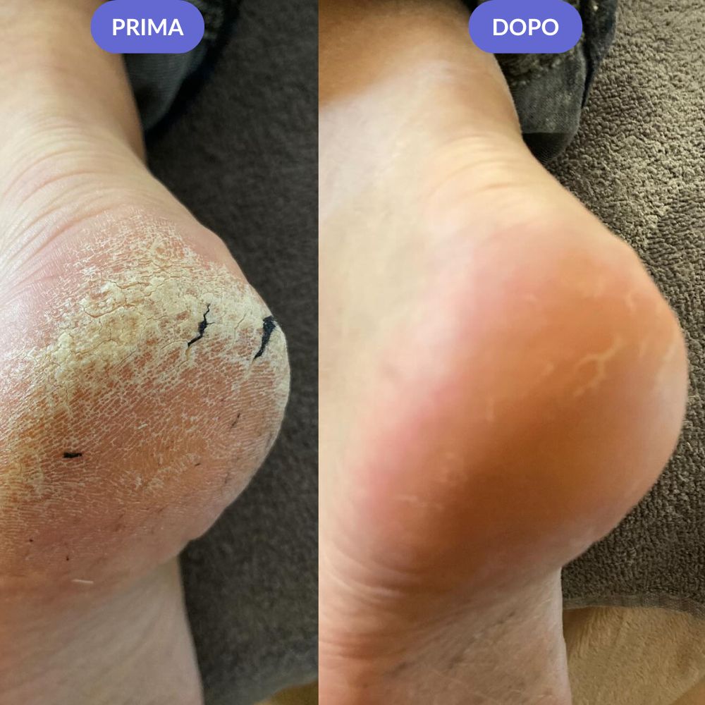 Lima Elettrica Pedicure PRO